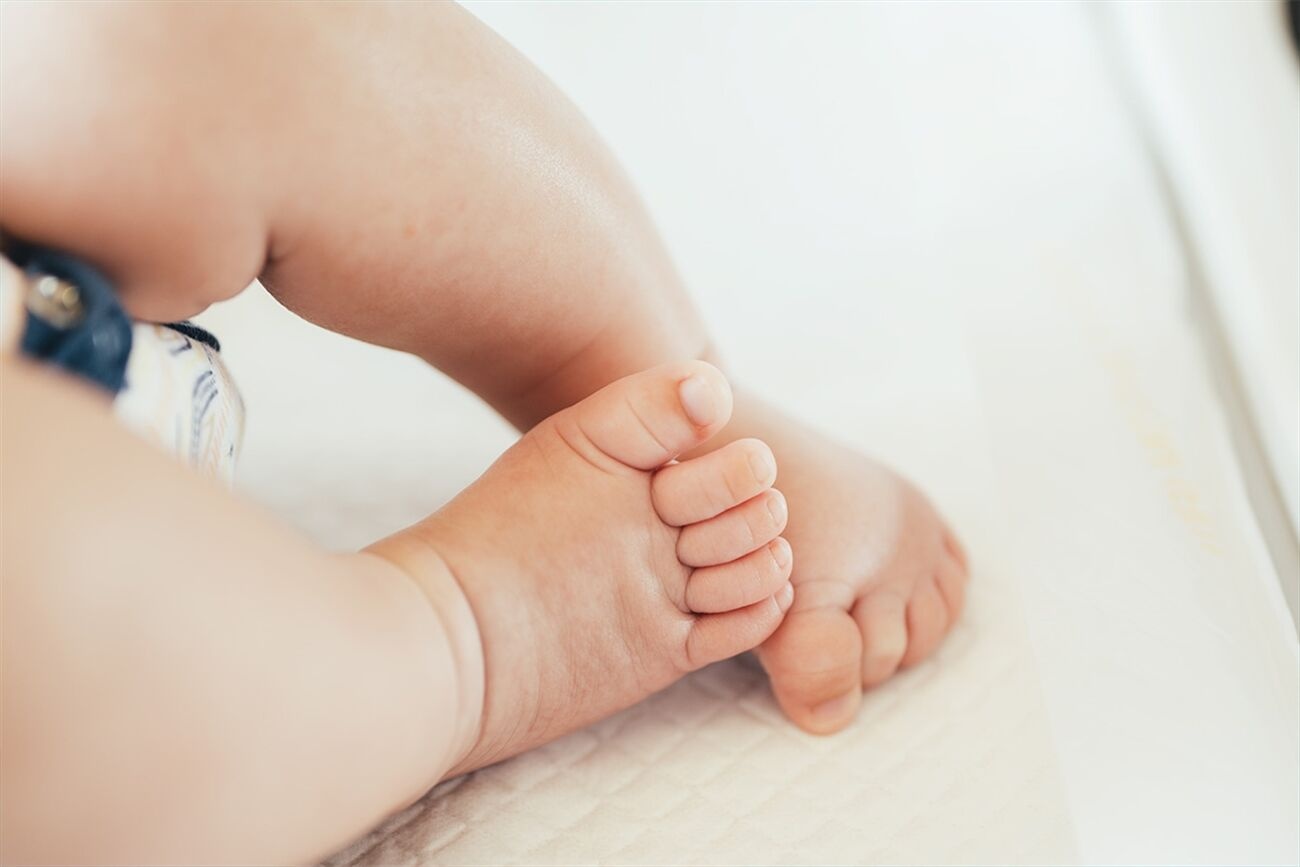 Doğumsal Çarpık Ayak Nedir?